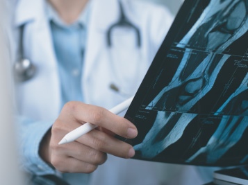 2 2048 Orthoplastics WS Products Vit E v1 09