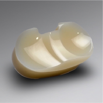 Direct Compression Moulding (DCM) - Product Photo