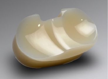 Direct Compression Moulding (DCM) - Product Photo